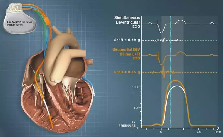 Высокотехнологичные методы лечения сердечной недостаточности тест нмо с ответами