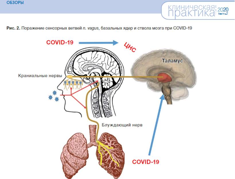 Вниманию коллег-неврологов и других специалистов, так или иначе связанных с COVID-19!