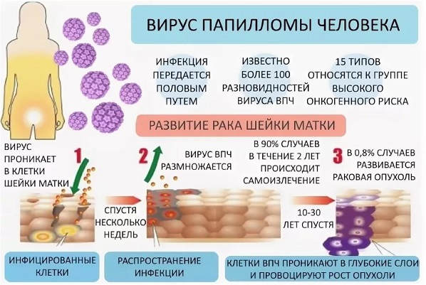 Папилломавирус у мужчин фото