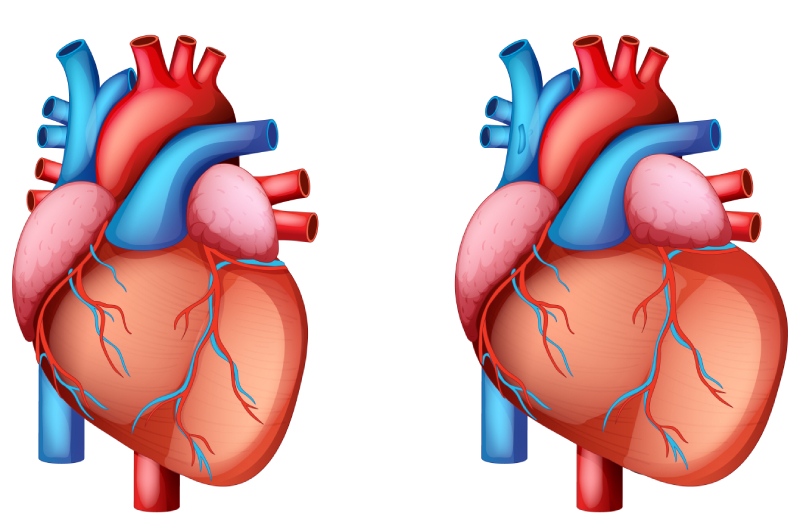 Легочное сердце симптомы