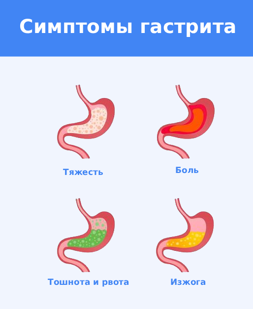 Симптомы гастрита