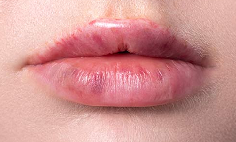 увеличение губ Москва