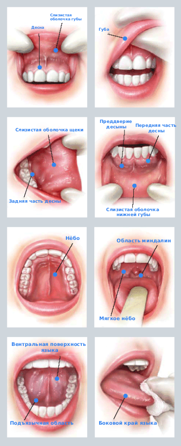 Опухоль во рту