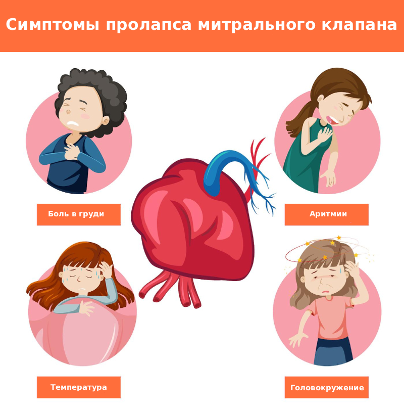 Симптомы пролапса минтрального канала Симптомы пролапса минтрального канала