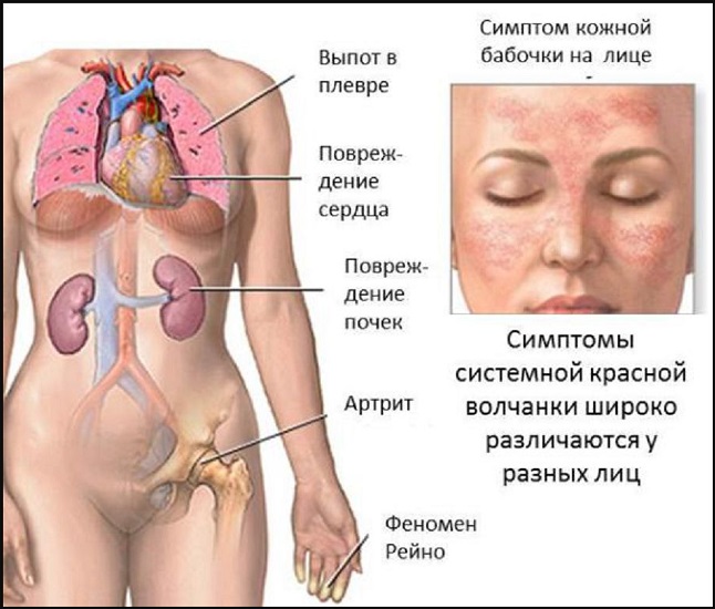 Лечение нефроптоза в клинике Hadassah не имеет равных в РФ