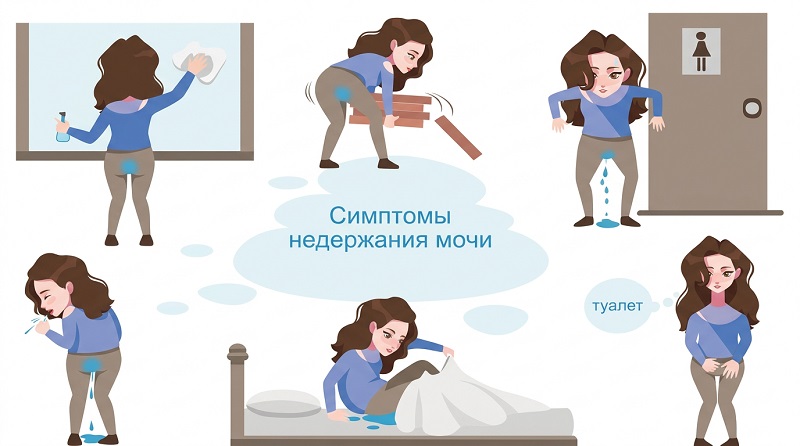 Недержание мочи у женщин причины и лечение