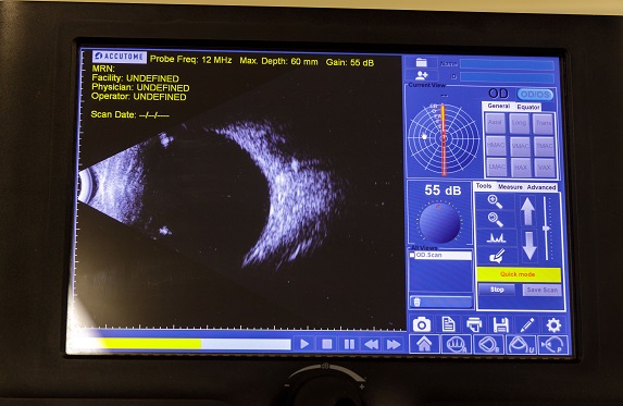 Результаты диагностики заболеваний глаз