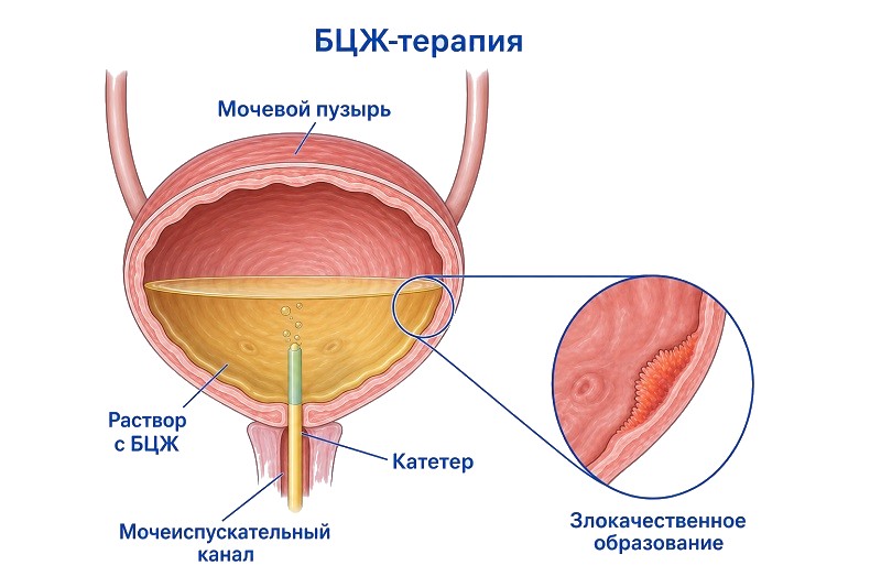 Вакцина БЦЖ